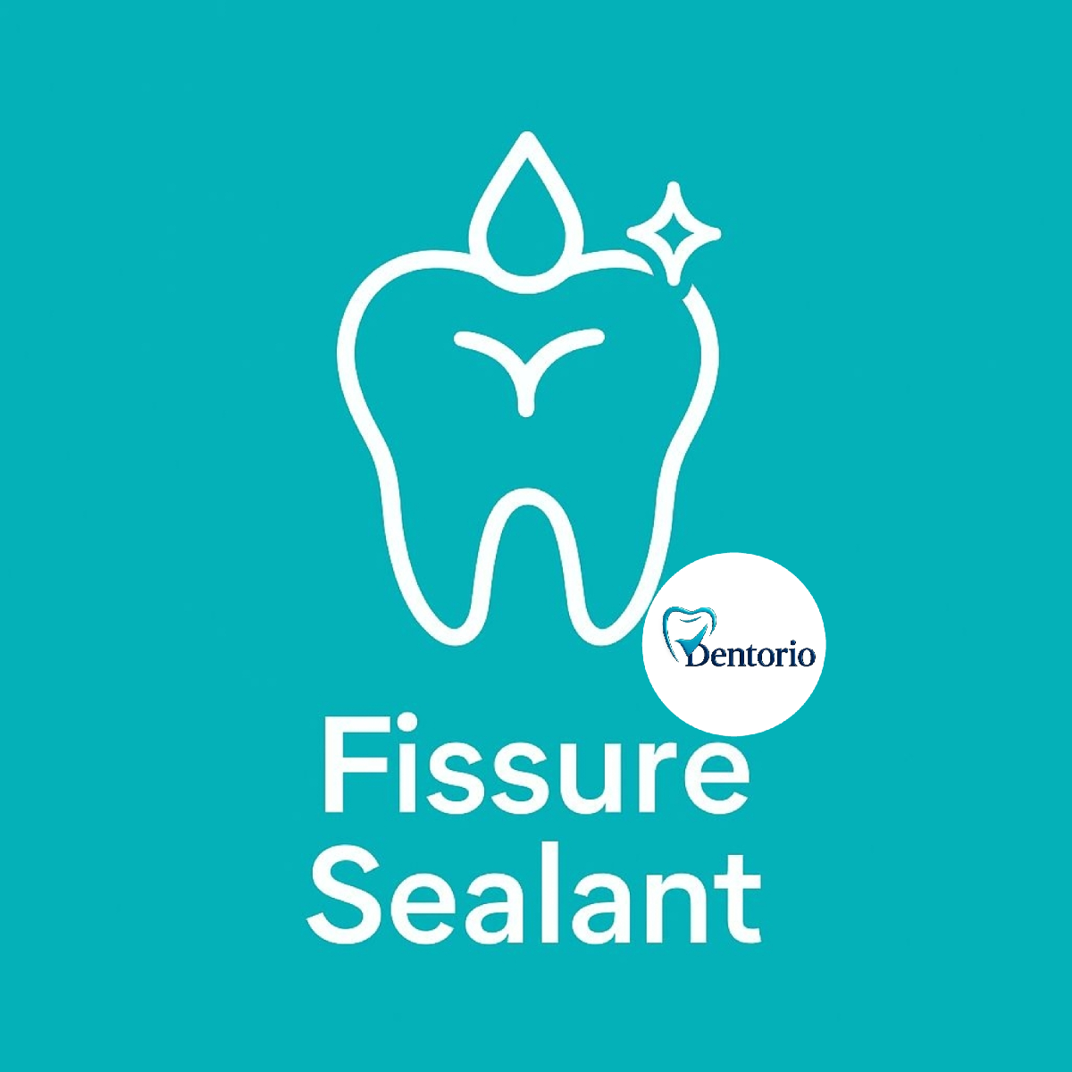 فیشور سیلانت