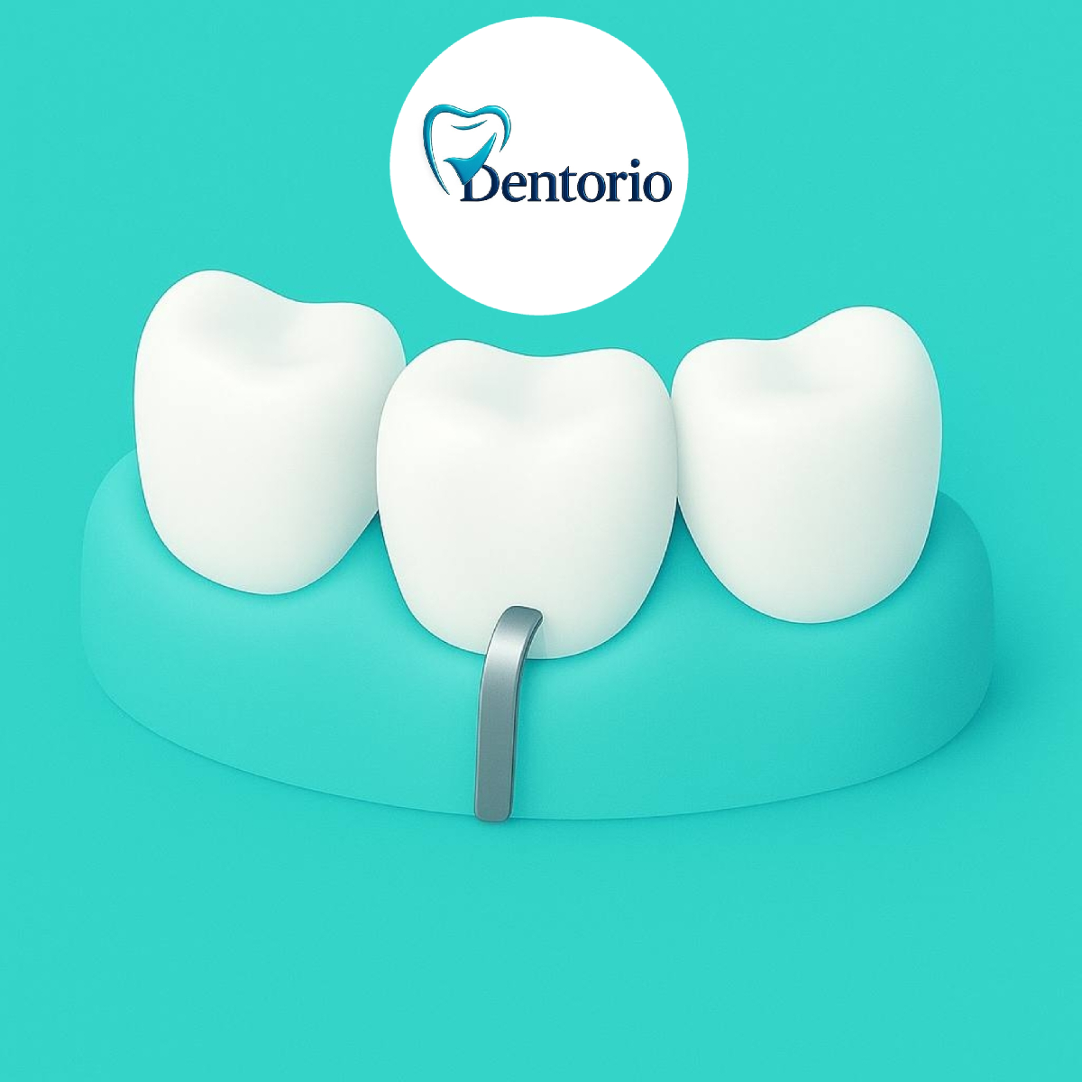 اره بین دندانی